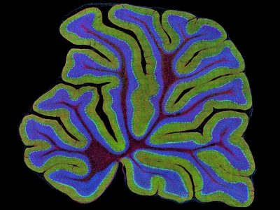 Imagen de un cerebelo de ratón. Un reciente estudio implica a esta estructura del sistema nervioso en un síntoma del trastorno del espectro autista relacionado con el gen SCN2A. Imagen: Thomas Deerinck, National Center for Microscopy and Imaging Research, University of California, San Diego, CC BY NC 2.0