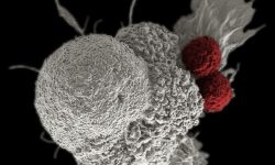 La inmunoterapia consiste en la activación de los mecanismos inmunitarios naturales para dirigido contra el cáncer. En la imagen se muestra una célula tumoral atacada por dos linfocitos T. Imagen: Rita Elena Serda, Duncan Comprehensive Cancer Center at Baylor College of Medicine, National Cancer Institute, National Institutes of Health.