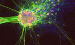 Neuronas derivadas de células madre pluripotentes inducidas. Imagen: National Center for Advancing Translational Sciences. CC BY 2.0 https://creativecommons.org/licenses/by/2.0/).