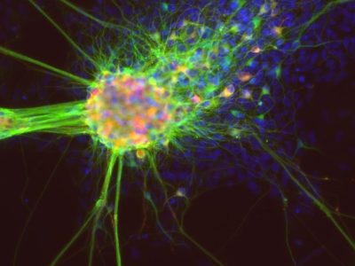 Neuronas derivadas de células madre pluripotentes inducidas. Imagen: National Center for Advancing Translational Sciences. CC BY 2.0 https://creativecommons.org/licenses/by/2.0/).