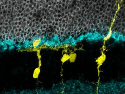 Células de la glía de Müller regenerando la retina. Imagen: Tom Reh, Ph.D. (CC BY NC https://creativecommons.org/licenses/by-nc/2.0/).