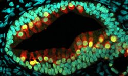 Sección de un organoide del oído interno obtenido a partir de células madre humanas.  Imagen: Karl R. Koehler, Ph.D., Indiana University School of Medicine (CC BY-NC 2.0) .