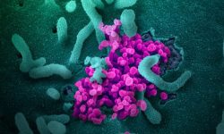 Imagenes de partículas de coronavirus SARS-CoV-2 emergiendo de una célula infectada. Imagen: National Institute of Allergy and Infectious Diseases. CC BY 2.0 (https://creativecommons.org/licenses/by/2.0/).