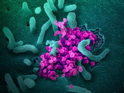 Imagenes de partículas de coronavirus SARS-CoV-2 emergiendo de una célula infectada. Imagen: National Institute of Allergy and Infectious Diseases. CC BY 2.0 (https://creativecommons.org/licenses/by/2.0/).