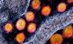 Particulas de coronavirus SARS-CoV-2. Imagen: NIAID, NIH.