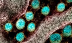 Particulas de coronavirus SARS-CoV-2. Imagen: NIAID, NIH.