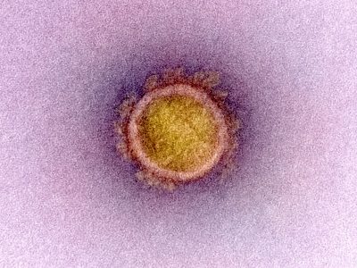 Imagen de un coronavirus. Imagen: National Institute of Allergy and Infectious Diseases, National Institute of Health.
