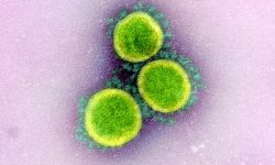 Partículas de coronavirus. Imagen:  NIAID Integrated Research Facility (IRF), Fort Detrick, Maryland. CC BY 2.0 (https://creativecommons.org/licenses/by/2.0/).
