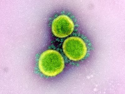 Partículas de coronavirus. Imagen:  NIAID Integrated Research Facility (IRF), Fort Detrick, Maryland. CC BY 2.0 (https://creativecommons.org/licenses/by/2.0/).