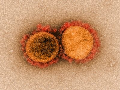 Partículas de coronavirus aisladas de un paciente. Imagen: National Institute of Allergy and Infectious Diseases, NIH.