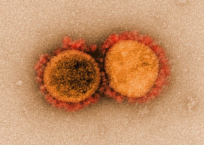 Partículas de coronavirus aisladas de un paciente. Un reciente estudio ha recreado la evolución del coronavirus responsable de COVID-19