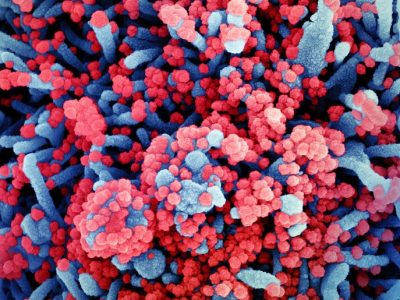 Imagen de una célula (azul) infectada con partículas de SARS-CoV-2 aisladas de un paciente de COVID-19. Imagen:  NIAID Integrated Research Facility (IRF), Fort Detrick, Maryland. CC BY 2.0 (https://creativecommons.org/licenses/by/2.0/).