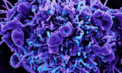 Imagen obtenida mediante microscopio electrónico de barrido y coloreada posteriormente de una célula apoptótica (en morado) infectada con partículas de SARS-CoV-2 (azules), aislada de una muestra de pacientes. Imagen: National Institute of Allergies and Infectious Diseases, NIAID.