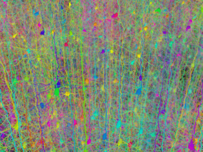 Imagen: Hermann Cuntz [CC BY 2.5 (http://creativecommons.org/licenses/by/2.5)], via Wikimed