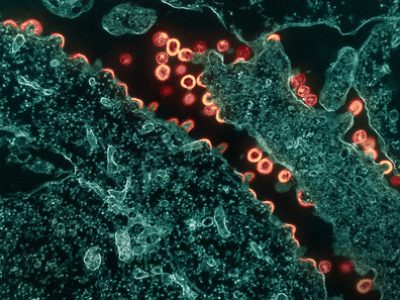 Micrografía de transmisión de partículas de virus HIV emergiendo y replicándose en una célula. Imagen: Instituto Nacional de Alergia y Enfermedades Infecciosas (NIAID)