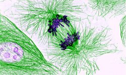Células en mitosis.