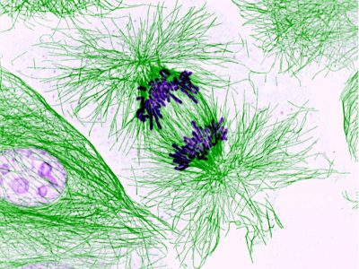 Células en división. Los cromosomas, en morado, se han duplicado y la separación de los dos juegos hacia las correspondientes células hijas es dirigida por las fibras del citoesqueleto  (en verde). Imagen: Nasser Rusan, National Heart, Lung, and Blood Institute, National Institutes of Health.