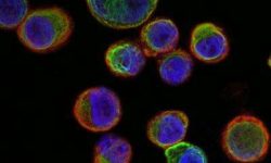 Las células tumorales circulantes son una de las fuentes del ADN tumoral en el torrente sanguíneo. Imagen: Universidad de Granada.