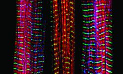 Tres fibras musculares, de las cuales la central carece de una proteína asociada a desórdenes musculares. Imagen: Christopher Pappas and Carol Gregorio, University of Arizona