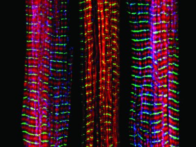 Tres fibras musculares, de las cuales la central carece de una proteína asociada a desórdenes musculares. Imagen: Christopher Pappas and Carol Gregorio, University of Arizona