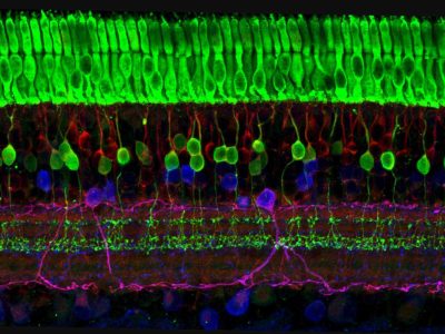 Diferentes capas de células nerviosas en la retina. Imagen: Wei Li, National Eye Institute, National Institutes of Health, EEUU.