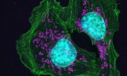 Células de cáncer de piel de ratón. Catherine and James Galbraith, Oregon Health and Science University, Knight Cancer Institute (Image and Video Gallery, National Institute of Health, EEUU).