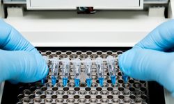 amplificación fragmentos análisis adn y arn