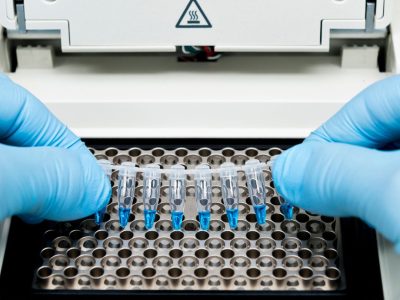 amplificación fragmentos análisis adn y arn