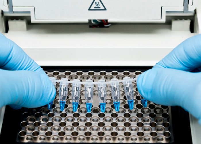 amplificación fragmentos análisis adn y arn