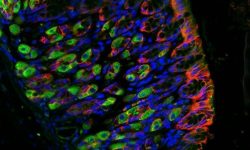 Imagen de una tinción de una sección del estómago humano en la que se muestra la presencia de ARHGAP26 (verde), proteína cadherina presente en el tejido epitelial del estómago (rojo) y los núcleos celulares (azul). A*STAR’s Genome Institute of Singapore (GIS).