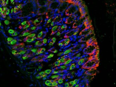 Imagen de una tinción de una sección del estómago humano en la que se muestra la presencia de ARHGAP26 (verde), proteína cadherina presente en el tejido epitelial del estómago (rojo) y los núcleos celulares (azul). A*STAR’s Genome Institute of Singapore (GIS).