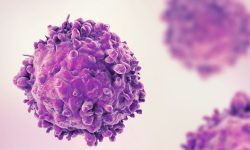 Algunas inmunoterapias consisten en reprogramar linfocitos de los pacientes para entrenarlos contra el cáncer