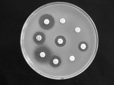 Prueba de susceptibilidad a antibióticos por difusión de discos con antibiótico en la que la cepa bacteriana es resistente a unos antibióticos y no a otros. Imagen: Microrao, Dominio público, vía Wikimedia Commons.
