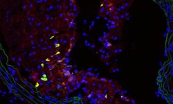 Células nestina+ en una placa aterosclerótica (en amarillo y rojo) en la arteria braquial de un ratón adulto. La capa de células musculares (verde) delimita la luz del vaso. Imagen: CNIC