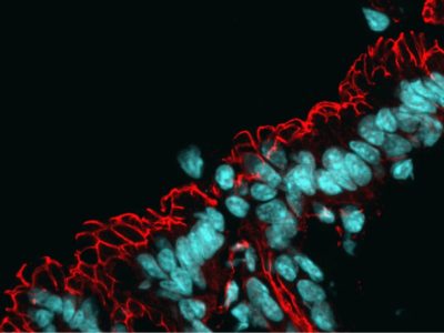 Microscopía del intestino, con los núcleos teñidos en azul y la red de proteínas de barrera en rojo. La alteración de la microbiota intestinal está conectada con el envejecimiento / Manuel Montero Gómez de las Heras, CBM.