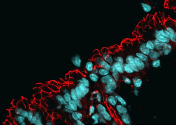 Microscopía del intestino, con los núcleos teñidos en azul y la red de proteínas de barrera en rojo. La alteración de la microbiota intestinal está conectada con el envejecimiento / Manuel Montero Gómez de las Heras, CBM.