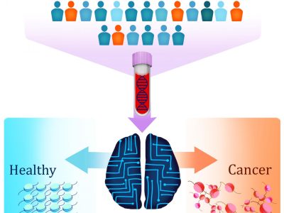 La nueva prueba de biopsia líquida, denominada DELFI, utiliza inteligencia artificial para detectar pacientes con cáncer por medio de la identificación de fragmentación del ADN alterada en sangre. Imagen: Carolyn Hruban.