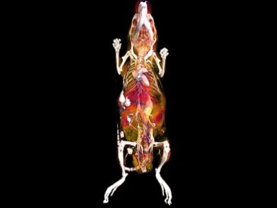 Una parte de las malformaciones venosas están causadas por mutaciones activadoras en el oncogén PIK3CA. En la imagen se muestra una angiografia por tomografia computerizada de uno de los ratones utilizados en el estudio – se puede observer en el costado derecho una malformacion venosa. Imagen cortesía de Sandra D Castillo.