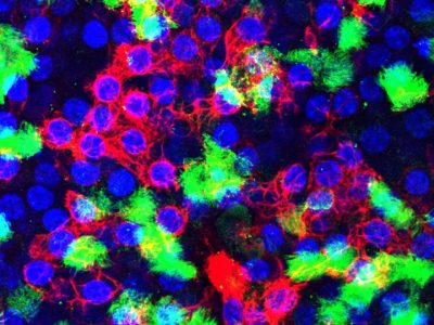 Los investigadores de la Universidad Duke estudian las células club, tipo de célula pulmonar que aumenta sus mecanismos de reparación del ADN para resistir la infección de la gripe. Imagen: Células ciliadas se muestran en verde, células basales en rojo, y núcleos celulares en azul.Nicholas Heaton Lab, Duke University.