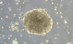 Cambios en el estrés osmótico de las células tumorales pueden generar resistencia o sensibilidad al Rigosertib, fármaco de quimioterapia prometedor en fase experimental para inhibir el crecimiento de las células cancerosas. Imagen: IIBM, CSIC-UAM.