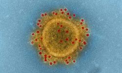 La mayor parte de las infecciones respiratorias que se producen durante los primeros años de vida son leves. Imagen:  Coronavirus. National Institute of Allergy and Infectious Diseases.