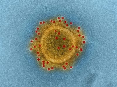 La mayor parte de las infecciones respiratorias que se producen durante los primeros años de vida son leves. Imagen:  Coronavirus. National Institute of Allergy and Infectious Diseases.