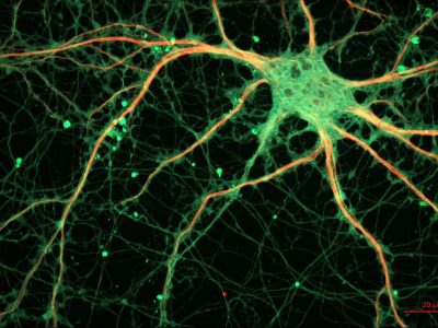El estudio describe cómo induce el axón nervioso la producción de la capa de mielina por parte de la célula de Schwann después de una lesión. Imagen: ZEISS Microscopy from Germany (Cultured Rat Hippocampal Neuron) CC BY 2.0 (https://creativecommons.org/licenses/by/2.0).