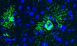 Dos atrocitos (en verde), con sus características prolongaciones en forma de estrella. La sobreproducción de una proteína por parte de estas células está relacionada con el desarrollo de Alzhéimer.