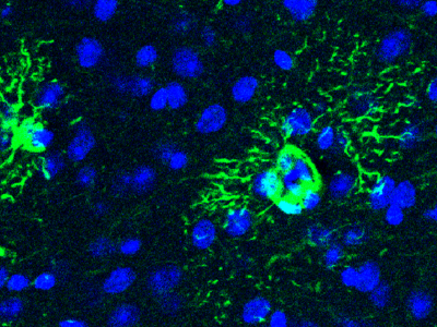 Dos atrocitos (en verde), con sus características prolongaciones en forma de estrella. La sobreproducción de una proteína por parte de estas células está relacionada con el desarrollo de Alzhéimer.