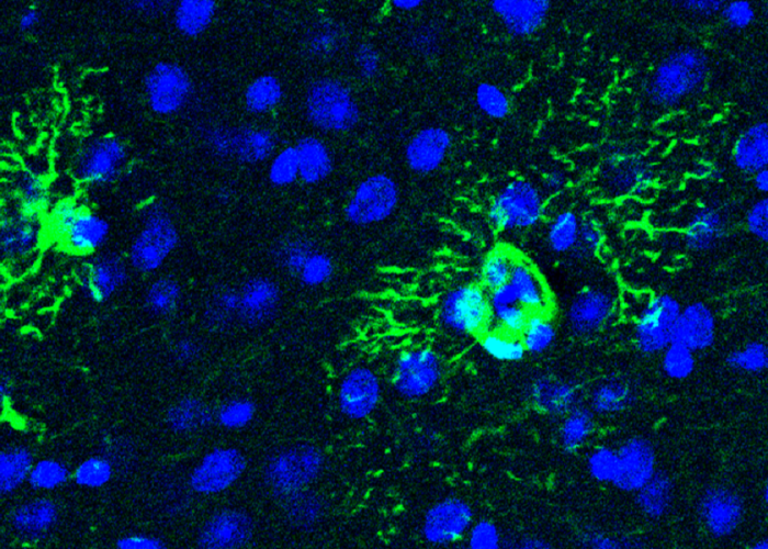 Dos atrocitos (en verde), con sus características prolongaciones en forma de estrella. La sobreproducción de una proteína por parte de estas células está relacionada con el desarrollo de Alzhéimer.