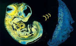 Los investigadores han identificado una señal clave que utiliza el feto para controlar el suministro de nutrientes desde la placenta. Imagen cortesía de los autores.