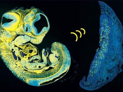 Los investigadores han identificado una señal clave que utiliza el feto para controlar el suministro de nutrientes desde la placenta. Imagen cortesía de los autores.