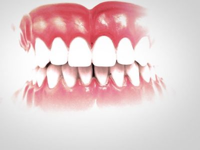 La periodontitis es una enfermedad inflamatoria que afecta a los tejidos blandos de la cavidad bucal. Imagen: Frank Bordinny (CC BY 2.0 https://creativecommons.org/licenses/by/2.0/es/).