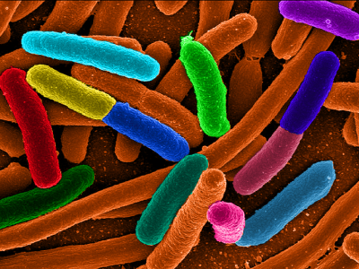 Los investigadores modificaron cepas de Escherichia coli, mediante ingeniería genética, para incorporarles, tres circuitos genéticos que generaban distintas respuestas antitumorales. Imagen: Escherichia coli By Mattosaurus. Commons